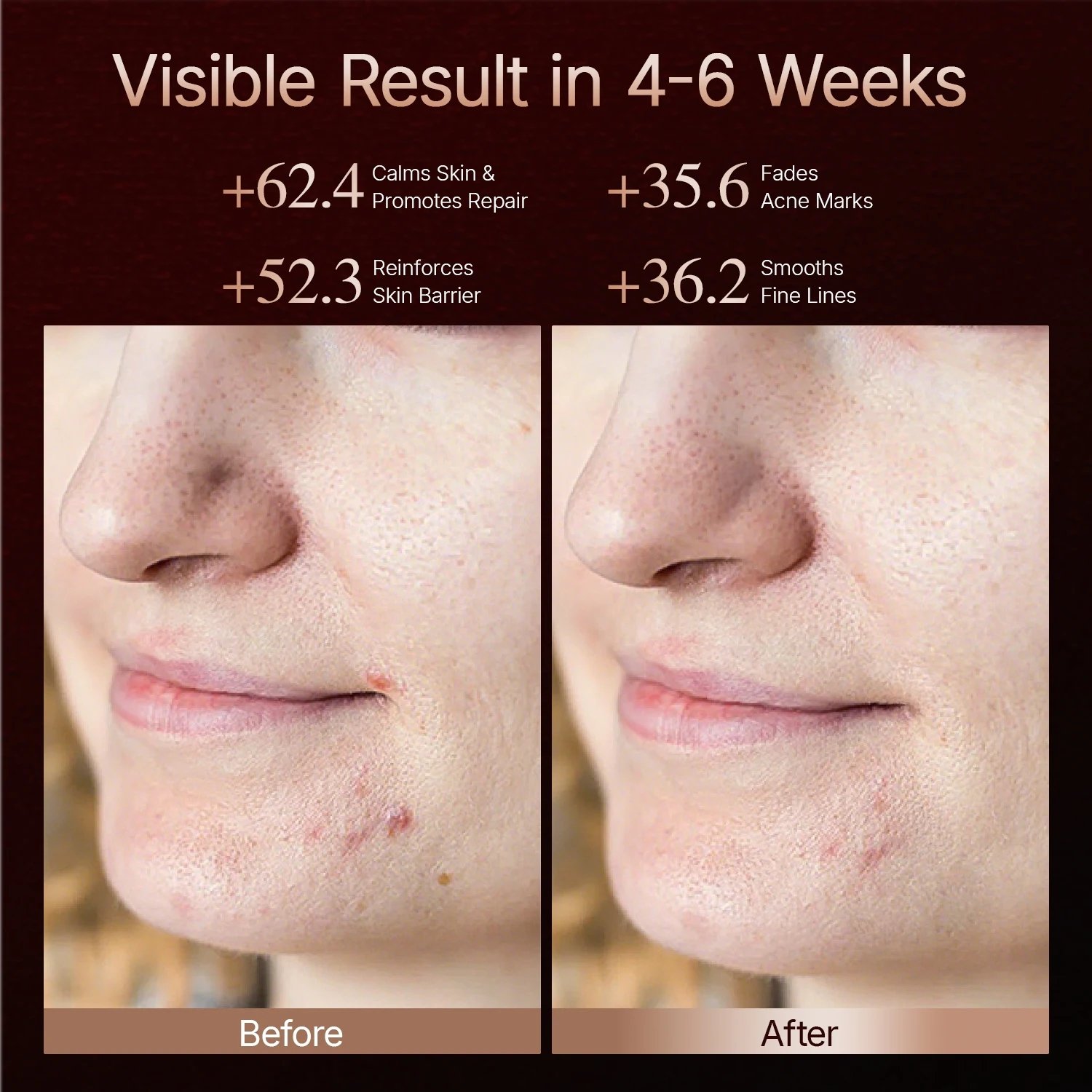 Skin before and after 4–6 weeks